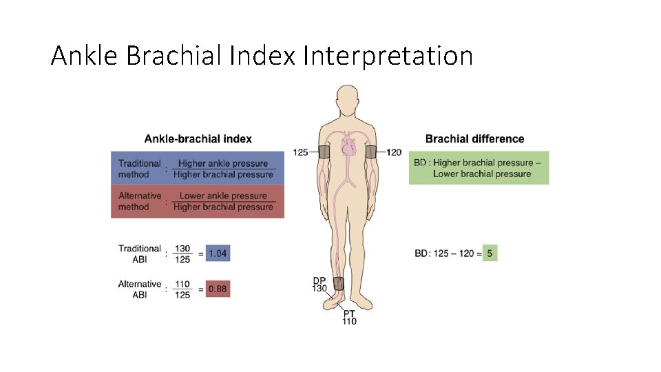 Ankle Brachial Index Interpretation Ankle Brachial Index Interpretation