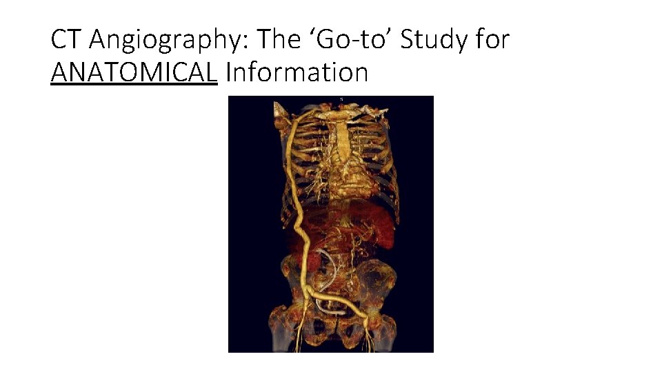 CT Angiography: The ‘Go-to’ Study for ANATOMICAL Information CT Angiography: The ‘Go-to’ Study for ANATOMICAL Information