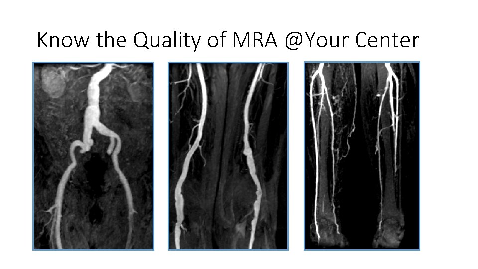 Know the Quality of MRA @Your Center Know the Quality of MRA @Your Center