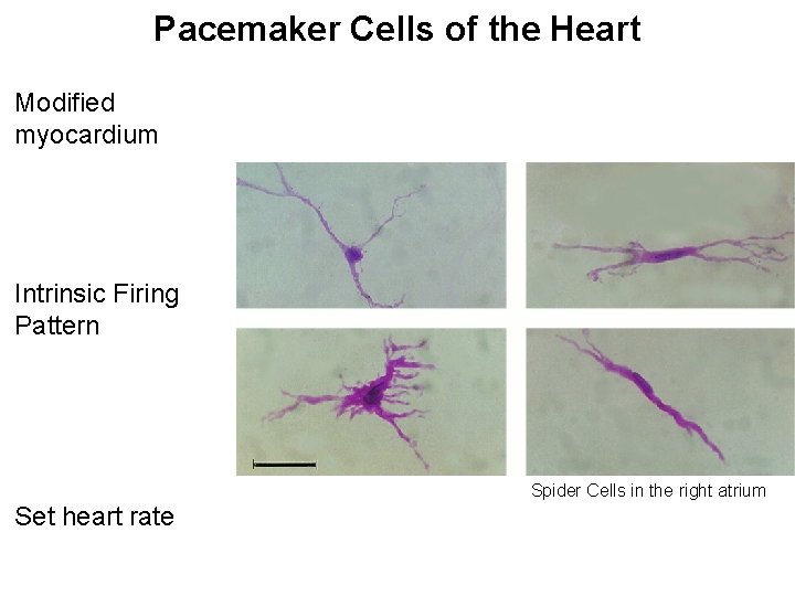 Pacemaker Cells of the Heart Modified myocardium Intrinsic Firing Pattern Spider Cells in the
