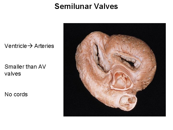 Semilunar Valves Ventricle Arteries Smaller than AV valves No cords 
