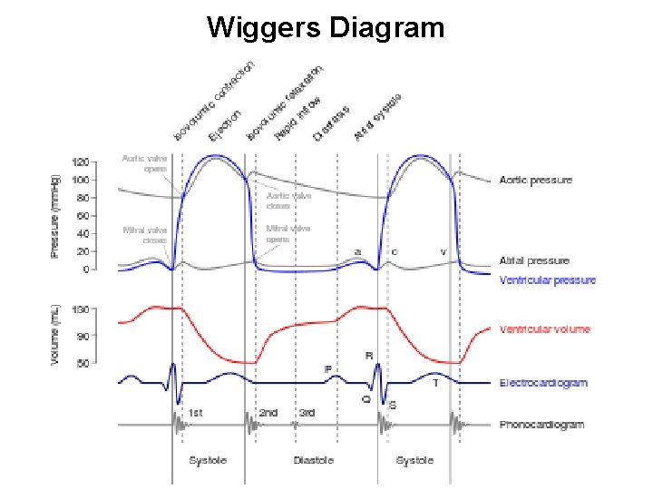 Wiggers Diagram 