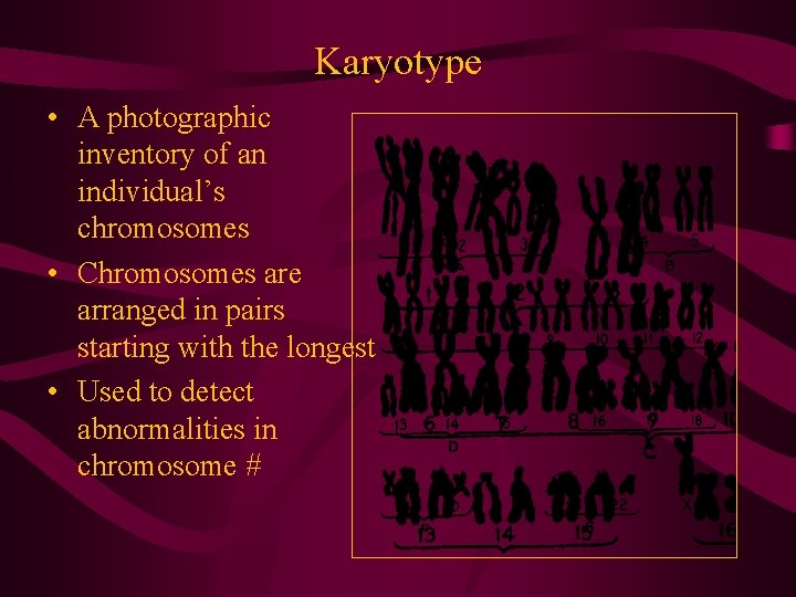 Karyotype • A photographic inventory of an individual’s chromosomes • Chromosomes are arranged in