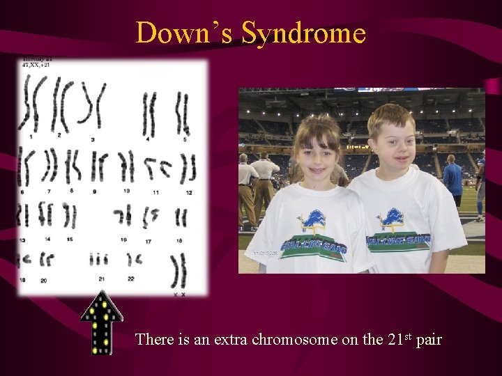 Down’s Syndrome There is an extra chromosome on the 21 st pair 