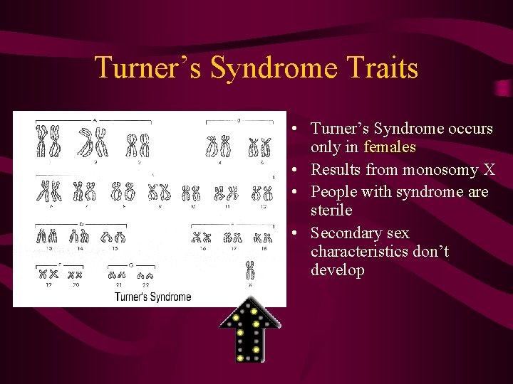 Turner’s Syndrome Traits • Turner’s Syndrome occurs only in females • Results from monosomy