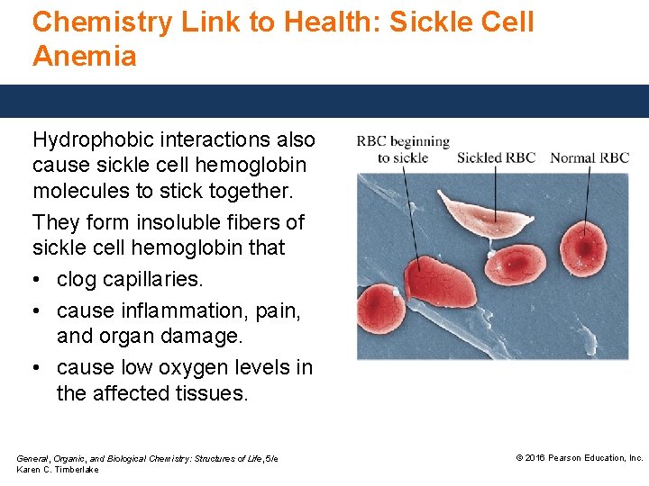 Chemistry Link to Health: Sickle Cell Anemia Hydrophobic interactions also cause sickle cell hemoglobin