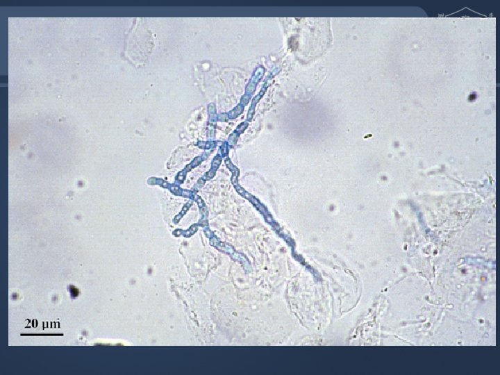 Diagnostic Tests KOH Preparations • Skin – – Two slides or slide and #15