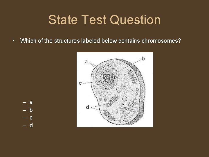 State Test Question • Which of the structures labeled below contains chromosomes? – –