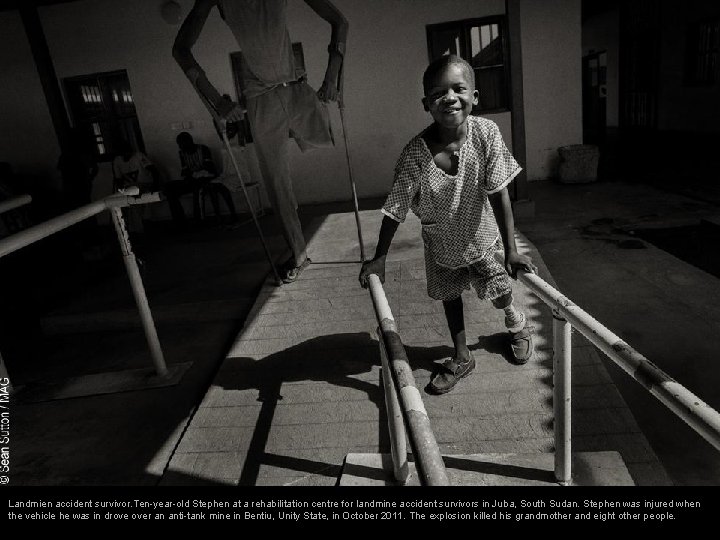 Landmien accident survivor. Ten-year-old Stephen at a rehabilitation centre for landmine accident survivors in Landmien accident survivor. Ten-year-old Stephen at a rehabilitation centre for landmine accident survivors in