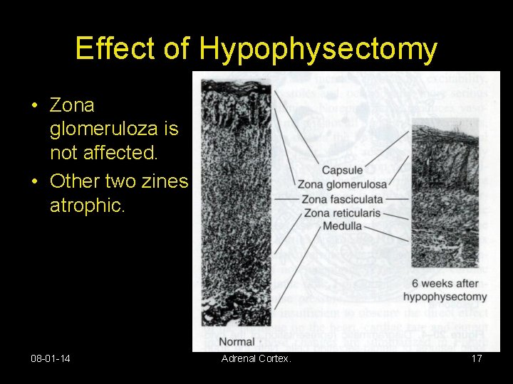 Effect of Hypophysectomy • Zona glomeruloza is not affected. • Other two zines atrophic.