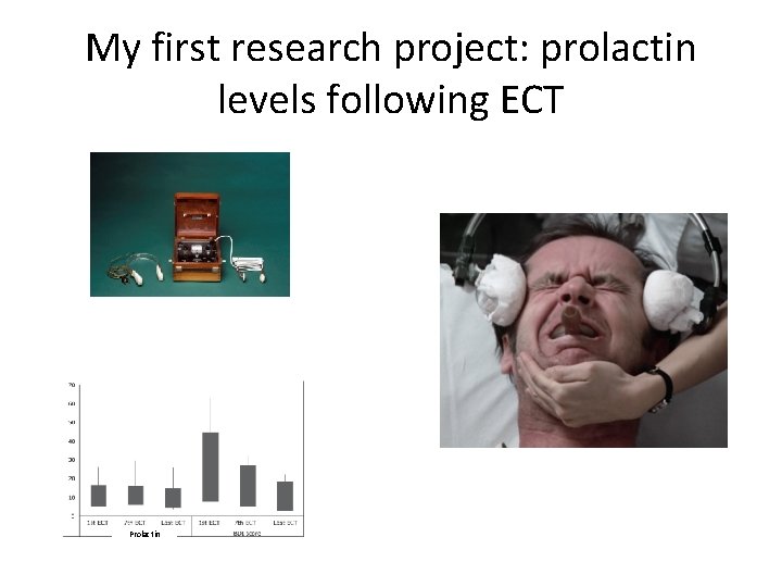 My first research project: prolactin levels following ECT Prolactin My first research project: prolactin levels following ECT Prolactin