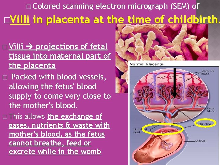 � Colored �Villi scanning electron micrograph (SEM) of in placenta at the time of