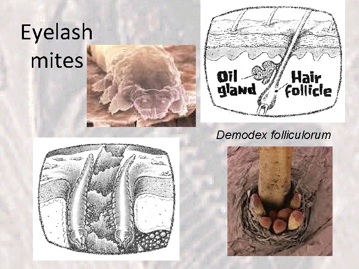 Eyelash mites Demodex folliculorum 