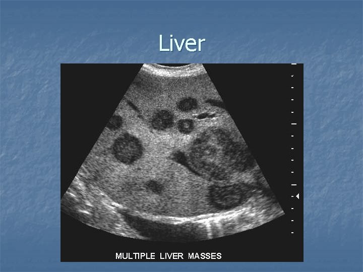 Liver 