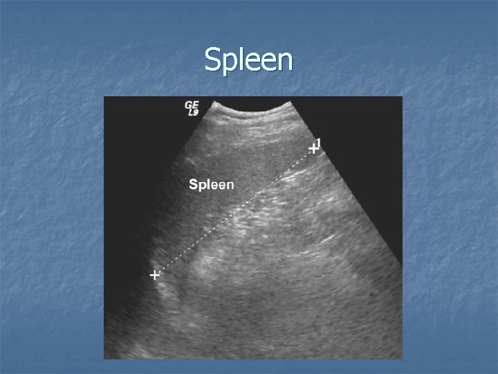 Spleen 