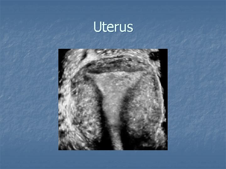 Uterus 