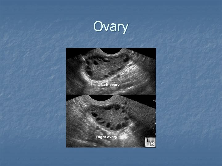 Ovary 