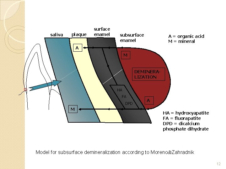 saliva plaque surface enamel subsurface enamel A = organic acid M = mineral A
