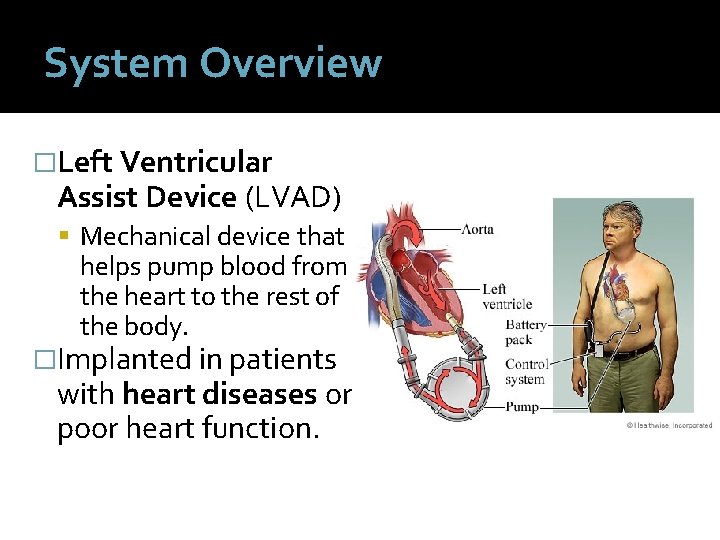 System Overview �Left Ventricular Assist Device (LVAD) Mechanical device that helps pump blood from