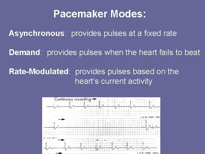 Pacemaker Modes: Asynchronous: provides pulses at a fixed rate Demand: provides pulses when the