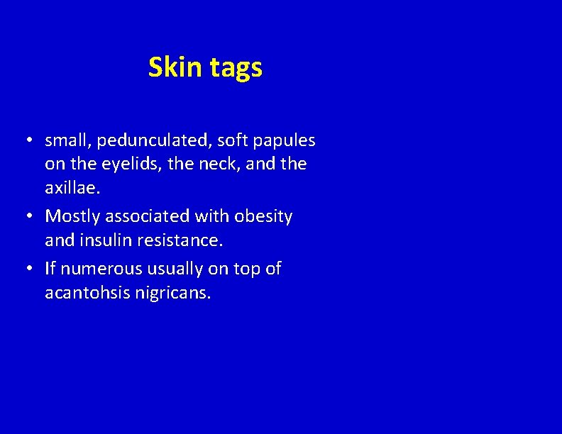 Skin tags • small, pedunculated, soft papules on the eyelids, the neck, and the