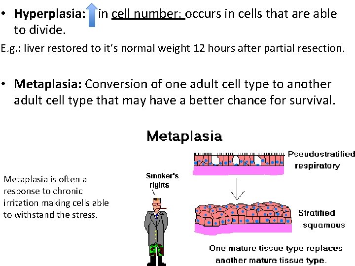  • Hyperplasia: in cell number; occurs in cells that are able to divide.
