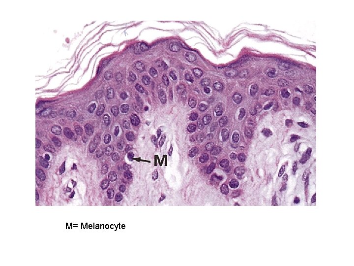 M= Melanocyte 