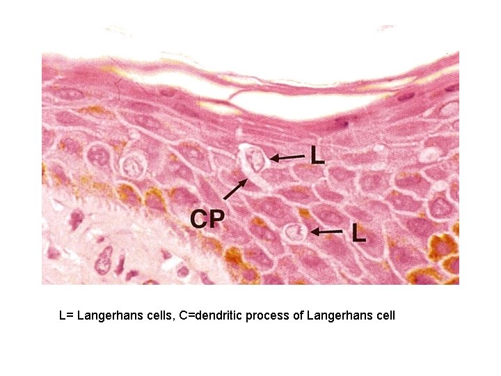 L= Langerhans cells, C=dendritic process of Langerhans cell 
