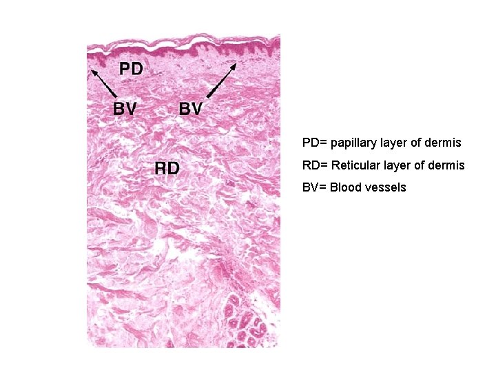 PD= papillary layer of dermis RD= Reticular layer of dermis BV= Blood vessels 