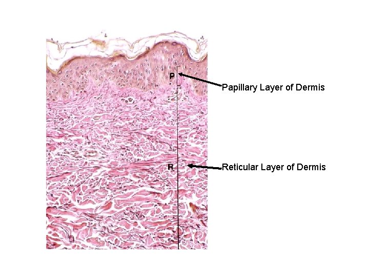Papillary Layer of Dermis Reticular Layer of Dermis 
