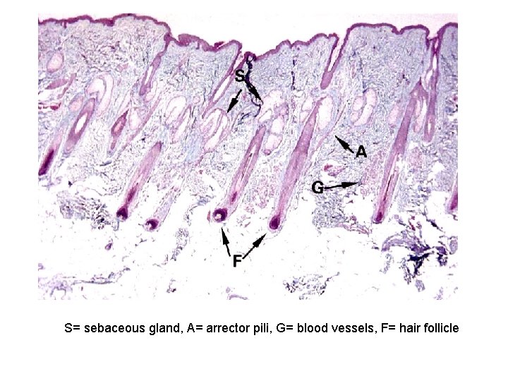 S= sebaceous gland, A= arrector pili, G= blood vessels, F= hair follicle 