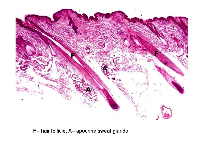 F= hair follicle, A= apocrine sweat glands 