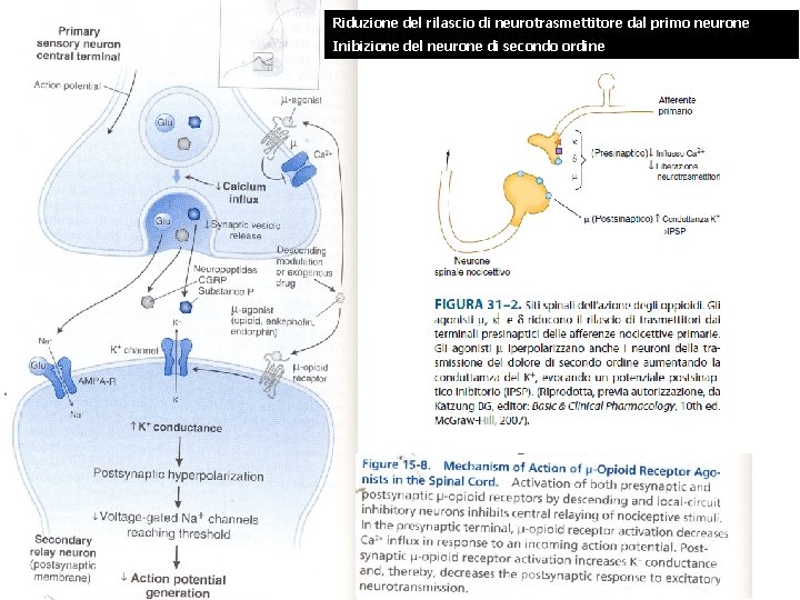 Riduzione del rilascio di neurotrasmettitore dal primo neurone Inibizione del neurone di secondo ordine