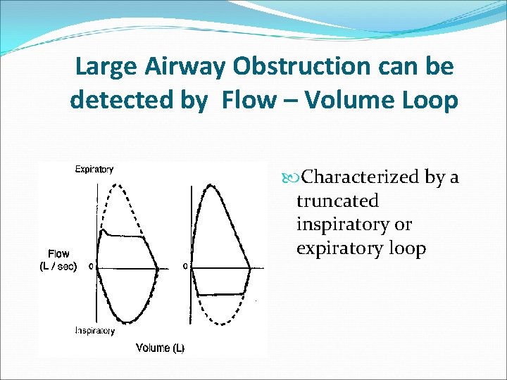 Large Airway Obstruction can be detected by Flow – Volume Loop Characterized by a