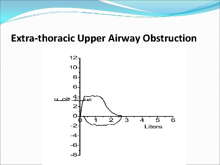 Extra-thoracic Upper Airway Obstruction 