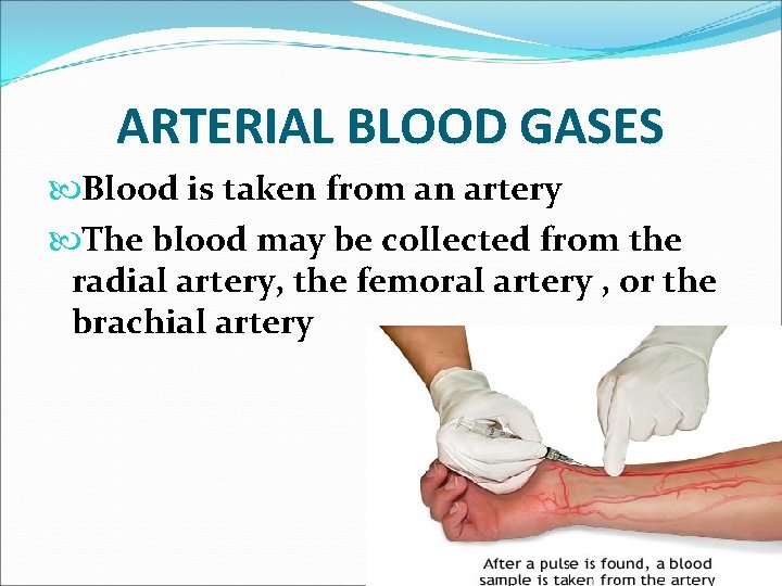 ARTERIAL BLOOD GASES Blood is taken from an artery The blood may be collected