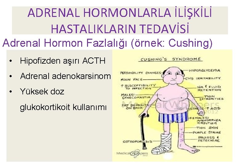 ADRENAL HORMONLARLA İLİŞKİLİ HASTALIKLARIN TEDAVİSİ Adrenal Hormon Fazlalığı (örnek: Cushing) • Hipofizden aşırı ACTH ADRENAL HORMONLARLA İLİŞKİLİ HASTALIKLARIN TEDAVİSİ Adrenal Hormon Fazlalığı (örnek: Cushing) • Hipofizden aşırı ACTH