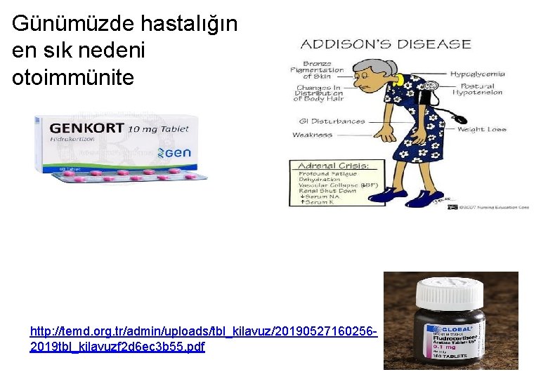 Günümüzde hastalığın en sık nedeni otoimmünite http: //temd. org. tr/admin/uploads/tbl_kilavuz/201905271602562019 tbl_kilavuzf 2 d 6