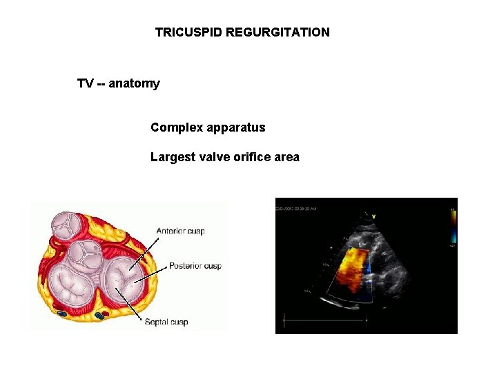TRICUSPID REGURGITATION TV -- anatomy Complex apparatus Largest valve orifice area 