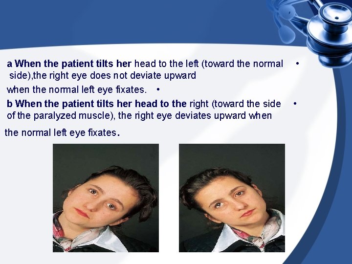 a When the patient tilts her head to the left (toward the normal side),