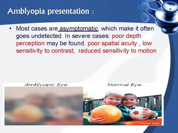 Amblyopia presentation : • Most cases are asymptomatic, which make it often goes undetected.