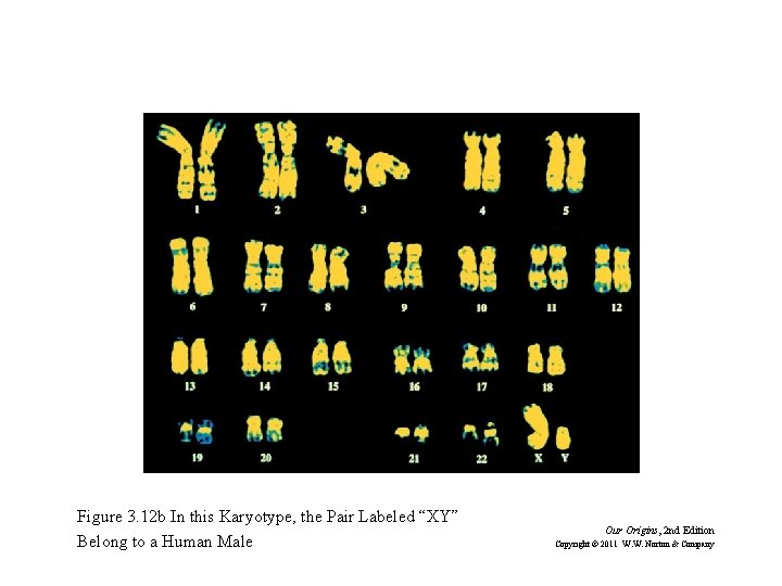 Figure 3. 12 b In this Karyotype, the Pair Labeled “XY” Belong to a