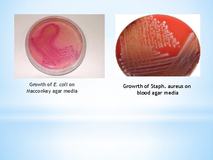 Growth of E. coli on Macconkey agar media Growrth of Staph. aureus on blood