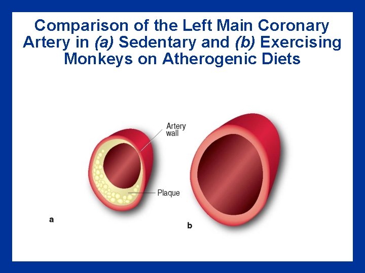 Comparison of the Left Main Coronary Artery in (a) Sedentary and (b) Exercising Monkeys Comparison of the Left Main Coronary Artery in (a) Sedentary and (b) Exercising Monkeys
