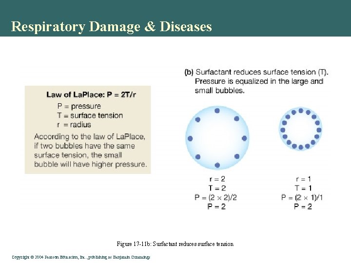 Respiratory Damage & Diseases Figure 17 -11 b: Surfactant reduces surface tension Copyright ©