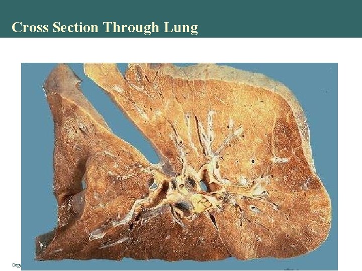 Cross Section Through Lung Copyright © 2004 Pearson Education, Inc. , publishing as Benjamin