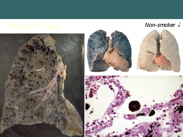 Smoker’s Lungs Copyright © 2004 Pearson Education, Inc. , publishing as Benjamin Cummings Non-smoker