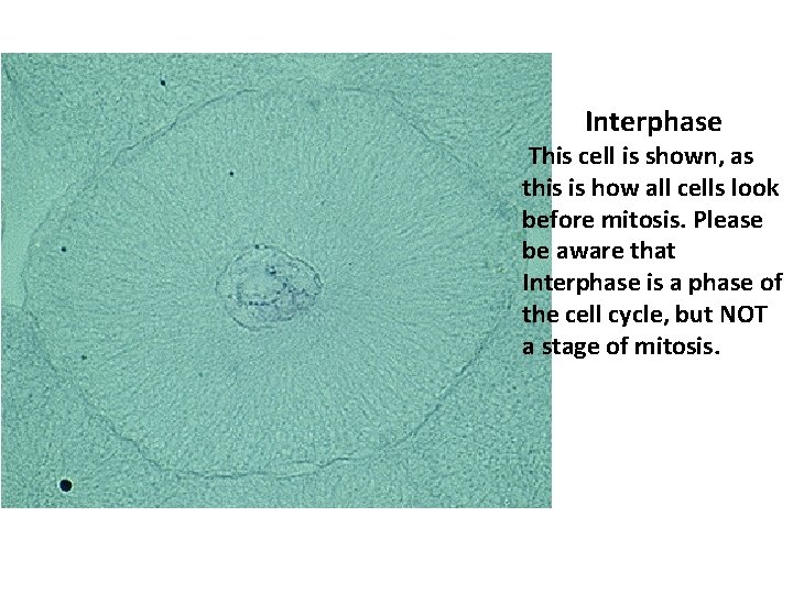 Interphase This cell is shown, as this is how all cells look before mitosis.