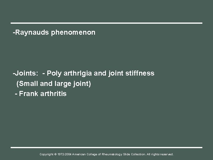 -Raynauds phenomenon -Joints: - Poly arthrlgia and joint stiffness (Small and large joint) -