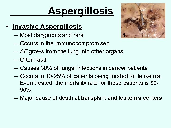 Aspergillosis • Invasive Aspergillosis – – – Most dangerous and rare Occurs in the